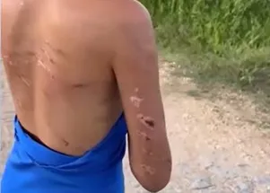 Adolescente-Itapopranga