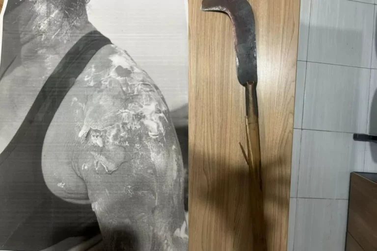 HOMEM-FEIJAO