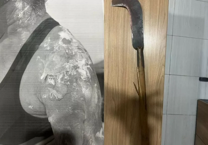 HOMEM-FEIJAO